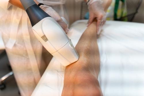 すね毛の脱毛施術を受けている男性の写真